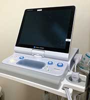超音波診断装置